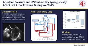 Image result for Afterload