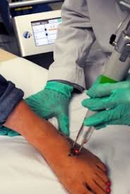 Madison Laser Tattoo Removal First To Offer Tattoo Removal Laser Technology With Duality In Madison Wi Astanza Laser Llc