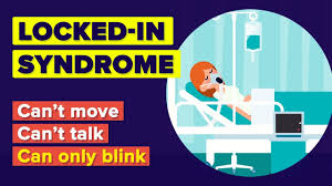They cannot produce speech or limb movements. Locked In Syndrome Physiopedia