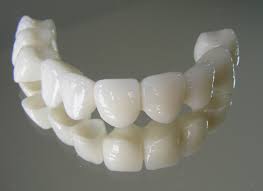 Zirkonyum diş porselen kaplama diş hekimliğinde kullanılan metalsiz estetik diş kaplama metal destekli diş köprüsü veya tek diş kaplaması olanlarda zirkonyum diş kaplama yapılabilir. What Is Zirconia Crown How Is It Prepared Cost Turkey Istanbul