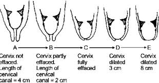 Internal Os External Os Stages Of Labor Delivering A Baby Cervix