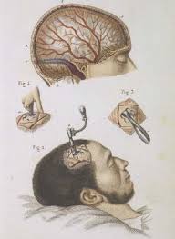 La Lobotomie Erreur Ou Progres Cerveau Psycho I just started raiding and i am going for deatherbringer for my mainhand to replace my axe of the deep woods. cerveau psycho