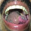 This causes hair follicles to swell into inflamed hair follicles usually looks like red pimples with a hair in the center of each one. 1
