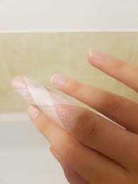 Mallet finger symptoms what causes mallet finger? Splinted Learning To Cope With Mallet Finger The Pathless Wood