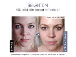 Amazon.com : DETOXIFYING Charcoal Blackhead Peel Off Face Mask