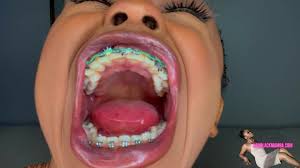 Braces Fetish - Porn Video Clips For Sale at iWantClips - Page 3