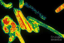 Risk factors include exposure to african green monkeys and certain bats; Marburg Virus Tem Photograph By Scott Camazine