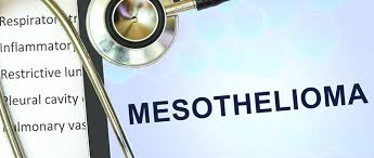 With only 3,000 new cases each year in the united states, mesothelioma is extremely rare and relatively. Mesothelioma Cancer Symptoms Prognosis Treatment