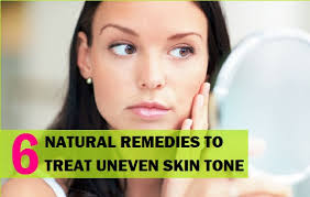 There are a number of different behavioral changes you can make to. 6 Best Natural Remedies To Treat Uneven Skin Tone On Face
