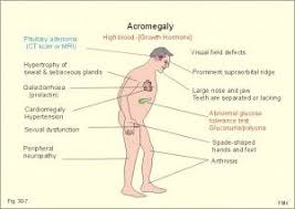 Medicine Science Com Endocrine System Nursing Endocrine System Medical Surgical Nursing