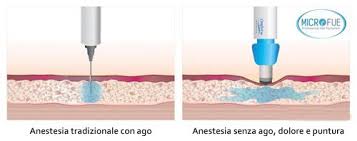 After 17 years in management at fedex, peter. Post Trapianto Capelli Che Cosa Succede Dopo Il Trapianto Di Capelli