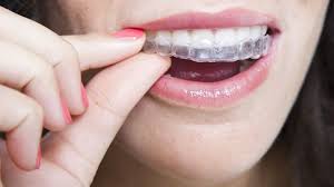 Tips For Adults Who Have Braces On Teeth Invisalign Teeth Straightening Invisible Braces