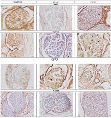 Image result for karp ln  tunel ort za