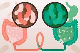 Image result for Fecal Transfer