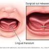 You can't make your tongue longer. 1