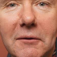 Rattlesnakes (Storycuts) by Irvine Welsh