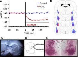 A wide variety of bk flooring options are available to you, such as design style, usage, and material. Chemogenetic Inhibition Reveals That Processing Relative But Not Absolute Threat Requires Basal Amygdala Journal Of Neuroscience