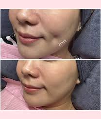 NBI Renewal & Apostille