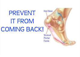 E Square 411x294 Running With Plantar Fasciitis Plantar Fasciitis Massage Therapy