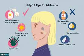 It is a holistic medicine triphala choornam is used as a face wash to prevent and cure melasma. How Melasma Is Treated