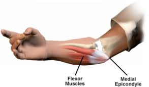 The second bone is the middle phalange ; Tennis Elbow Pain Singapore Specialist For Sports Injuries