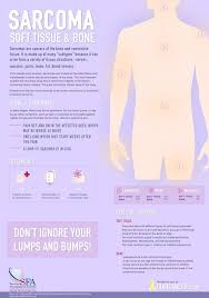 You may feel discomfort from staying in the same position for a long time. Thanks To Ihadcancer Com And Sarcoma Foundation Of America Cancer Facts Sarcoma Cancer Cancer Infographic
