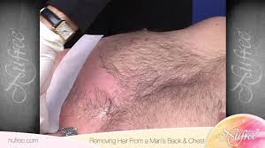 Nufree Finipil Removing Hair From A Man S Back Chest Youtube