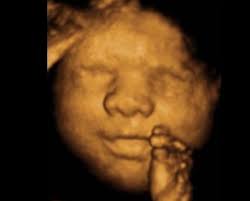 See more ideas about 4d ultrasound pictures, ultrasound pictures, 4d ultrasound. Deal 50 For 3d 4d Ultrasound Plus Gender Determination With Bella Baby 4d 50 Off 100 Value Certifikid