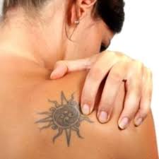 Ask your tattoo artist to use hydrogen peroxide to tattoo over the area you want faded. Painless Laser Tattoo Removal In Dubai Abu Dhabi Cost Price