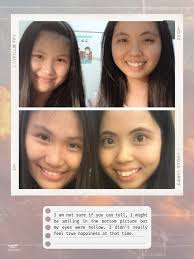 Understanding Anorexia: My Journey at 38kg and Raising Awareness