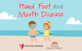 Identifying and treating teething rashes. Understanding Hand Foot And Mouth Disease Healthy Uh Health Articles University Hospitals Cleveland Oh University Hospitals