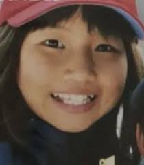 女性芸能人 有名人の整形事情 おしゃれまとめの人気アイデア pinterest 整形の館 メロ 有名人 芸能人