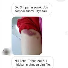 Salam sejahtera , sy ingin bertanya sedikit soalan , terlebih dahulu maaf sy mohon jika soalan sy ini agak menjijikan … maaf … usia kandungan sy skrg 26 minggu … sy ada bersama dgn suami dlm 2 kali pada isia kandungan skrg 25 minggu … tapi semasa suami menjilat kemaluan sy ada darah keluar , ini. Lufya Dedah Dipukul Suami Ketika Hamil