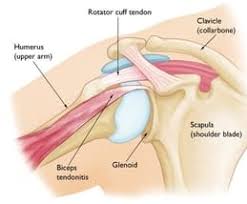D'habitude, la douleur au bras droit n'est pas symptomatique d'une urgence médicale. Douleur Au Bras Droit Signification Causes Et Traitements Soulage Dos Com
