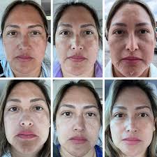 Cindy Rieger (@cindy_rieger_skin) • Instagram photos and videos