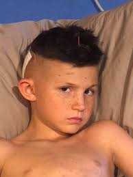 Judy from Open Mind Modalities Ruth McCarty, MS, L.Ac. Founder stopped by  to give Gavin a massage and some acupuncture-do you see that needle in his  head? 😂 he is feeling better.