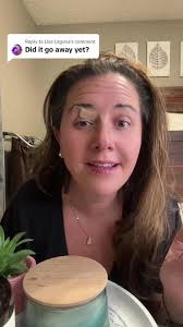 Xanthelasmata Castor Oil