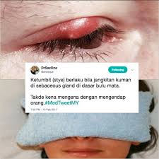 Sebelum kita mengetahui cara menghilangkan bau ketiak, ada baiknya kita mengetahui apa saja yang bisa menyebabkan ketiak menjadi berbau. Era On Twitter Ketumbit Bukan Sebab Mengintai Ni Doktor Bagi Petua Hilangkan Https T Co Xoh1bx19nn