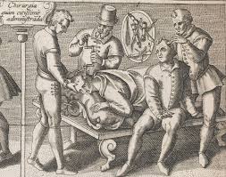 Bloodletting | History, Definition, Modern Uses, & Facts | Britannica