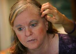 RIVERSIDE: City aims to ease dementia's strain