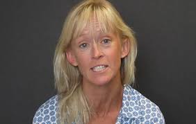 Knee Osteoarthritis (OA)