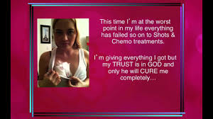 Special needs of young adults with cancer. Breast Cancer At Young Age Youtube