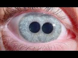 Tropismele, mutatiile si nastiile la plante. Top 5 Cele Mai Groaznice Mutatii Genetice Youtube