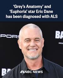 Eric Dane has been diagnosed with ALS, which is also known as Lou Gehrig's  disease. The 'Grey's Anatomy' star shared the news in a statement to People 