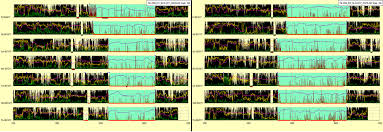 Image result for Actigraphy