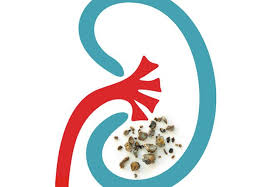 Pin On Health