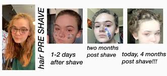 Not sure if i'm kidding or not about being hairier than your dad. Hair Growth After 4 Months Post Shave Looking To Find Out What I Need To Do To Start Promoting Growth And Healthy Curls My Hair Was Very Heat Damaged Before 3 Years