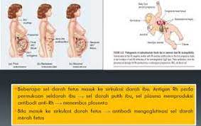 Check spelling or type a new query. Positif Atau Negatif Rhesus Sebagai Penentu Kehidupan Halaman 2 Kompasiana Com