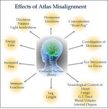 The Atlas Subluxation The Root Cause Agapeisforeveryone Wendy Felts Werley Williams Agapeuc Com Subluxation Upper Cervical Chiropractic Chiropractic