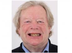 Angst vor dem Zahnarzt